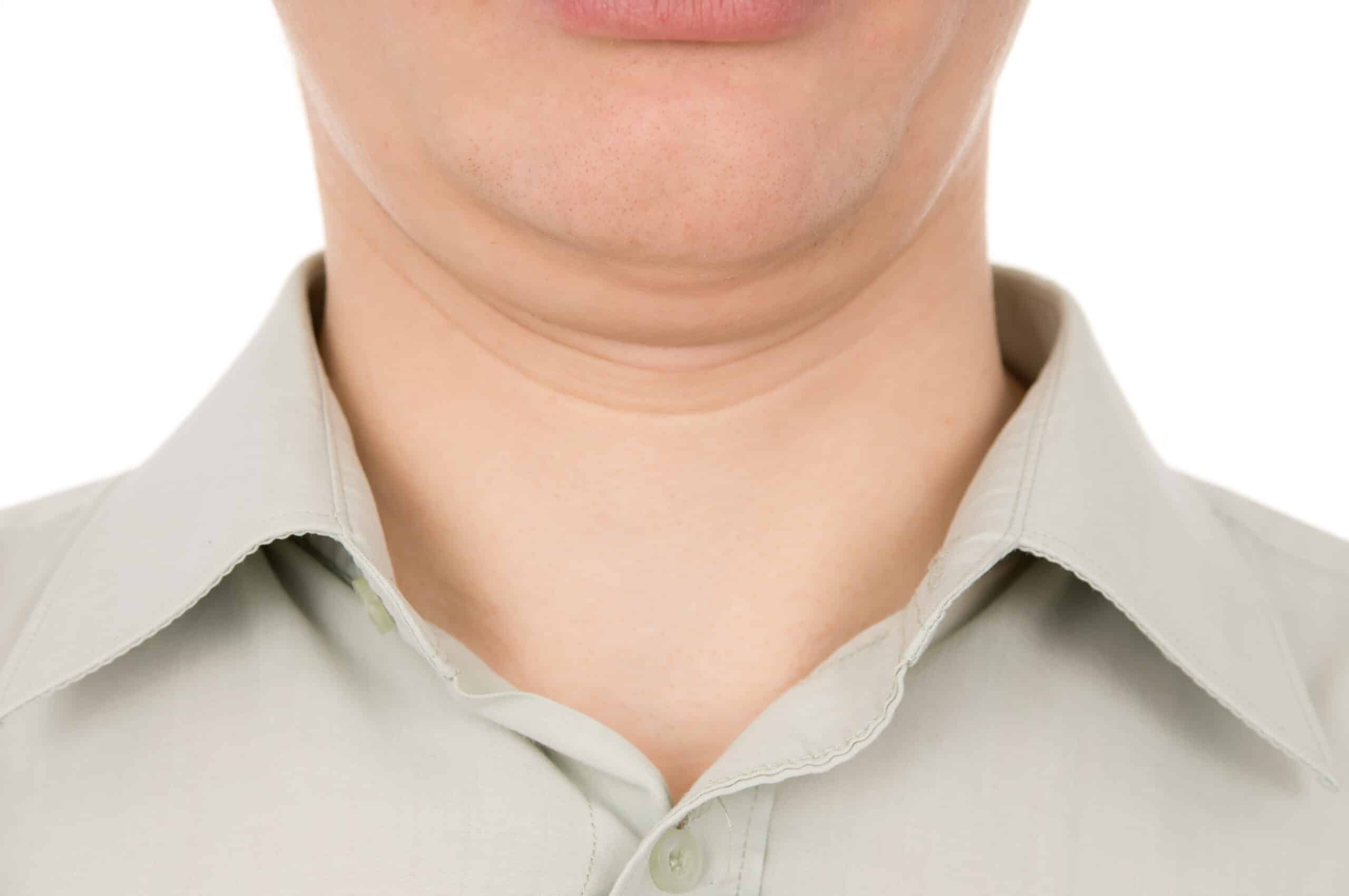 Four ways to lose that double chin