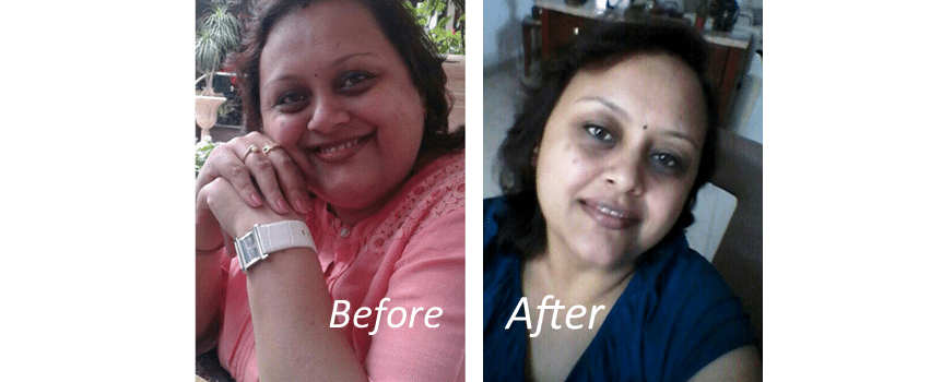 ‘After bariatric surgery, Healthifyme helped me continue to lose weight’