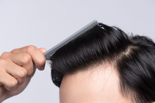 Datos gali užkirsti kelią plaukų slinkimui