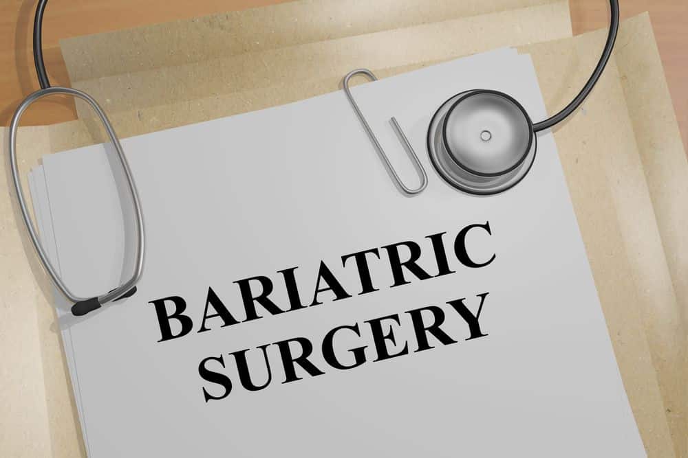 All You Need to Know About Bariatric Surgery