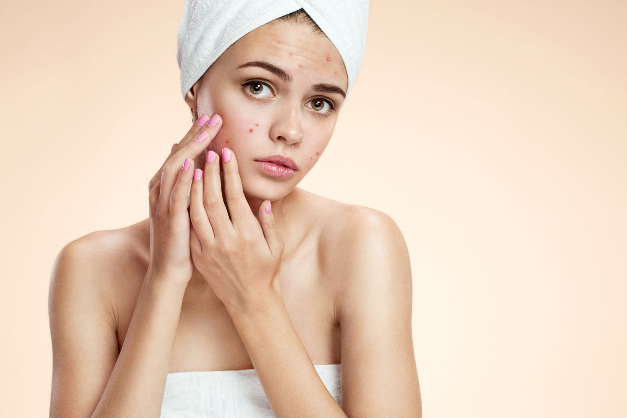 Acne: Types, Causes, Treatment and Prevention Tips