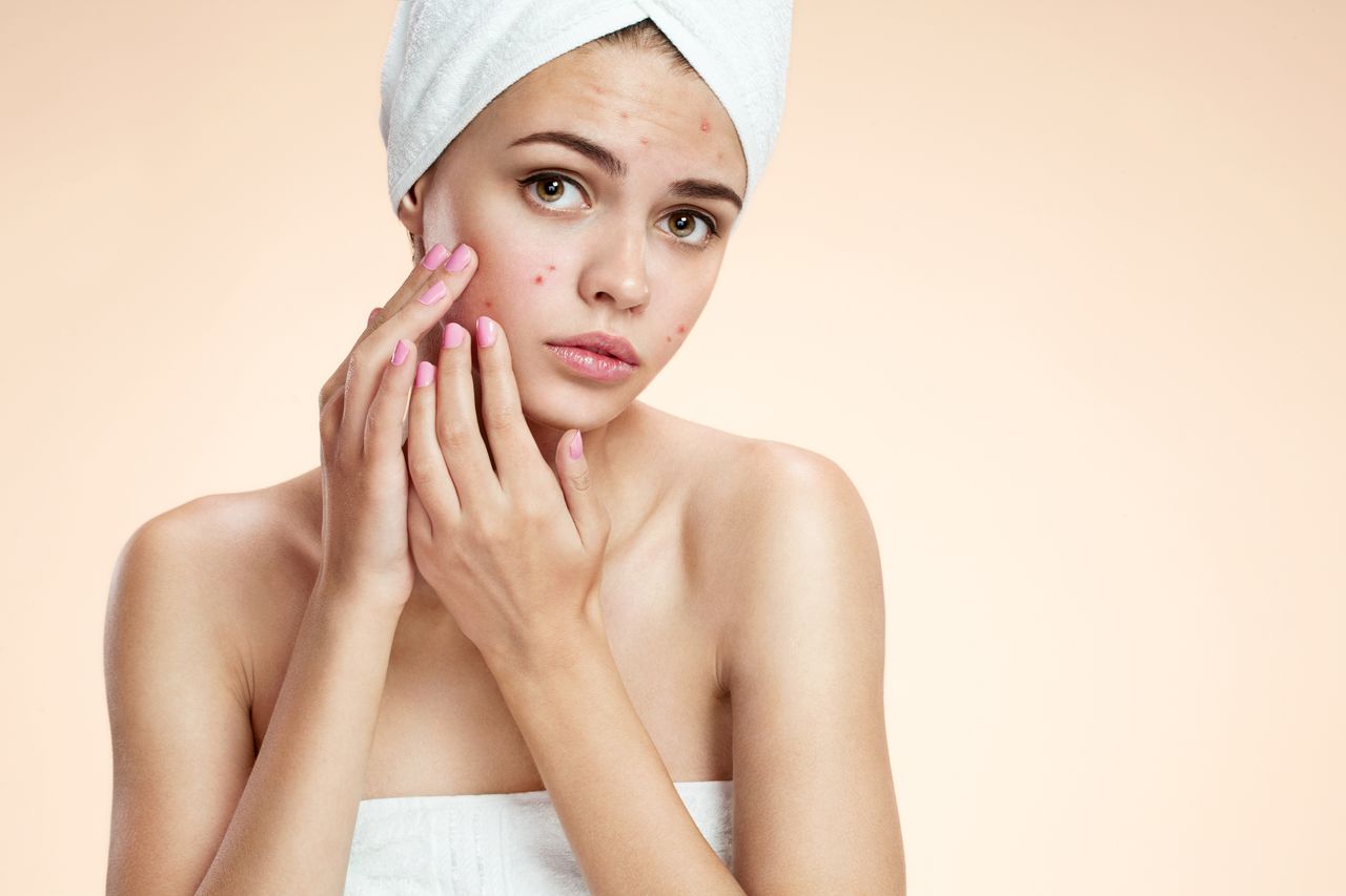 Acne: Types, Causes, Treatment and Prevention Tips- HealthifyMe