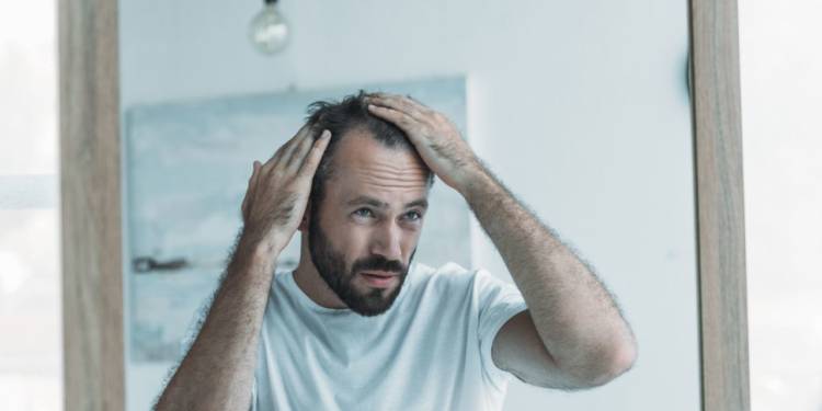 Weight Loss with Hair Loss: The Worrisome Connection - HealthifyMe Weight Loss with Hair Loss: The Worrisome Connection - HealthifyMe