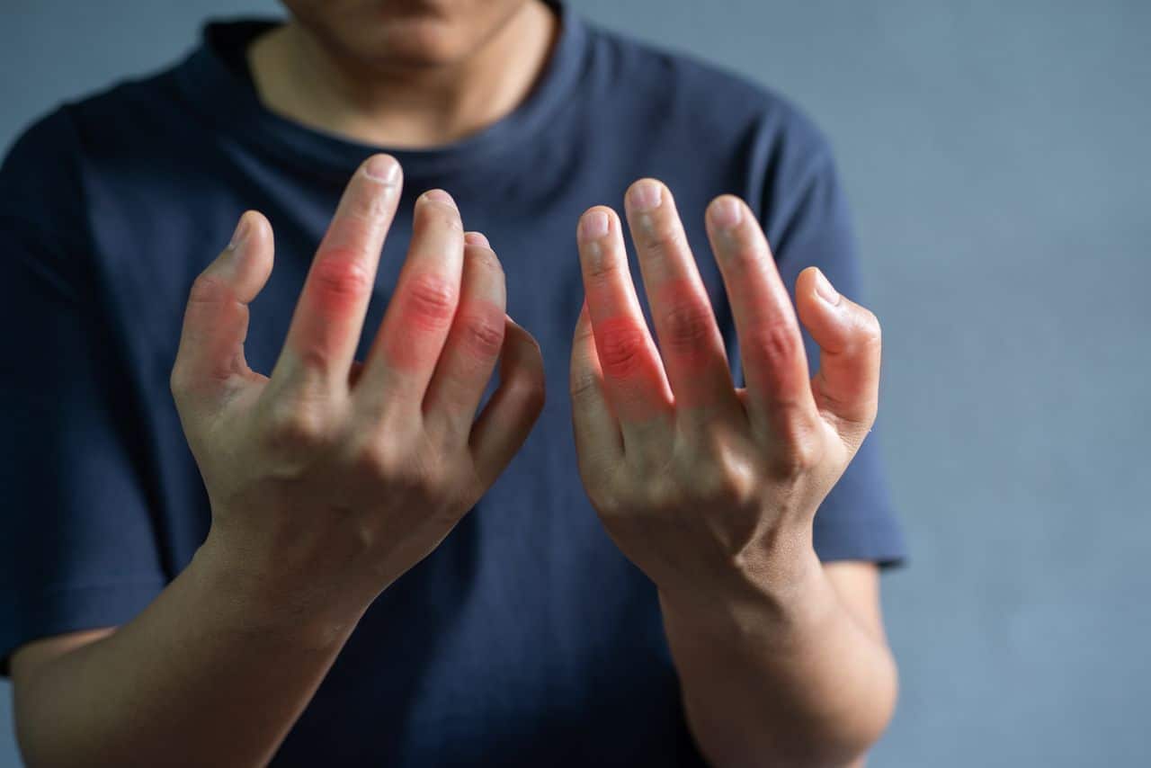 13 dalykų, kuriuos reikia žinoti apie gyvenimą sergant reumatoidiniu artritu