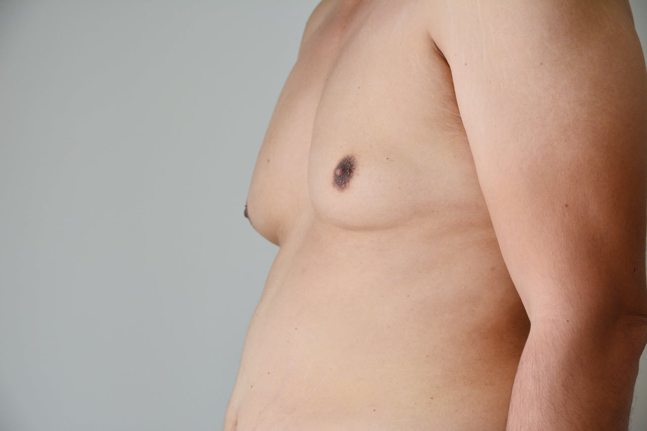 Understanding and Managing Chest Fat: Causes, Prevention, and Exercises- HealthifyMe