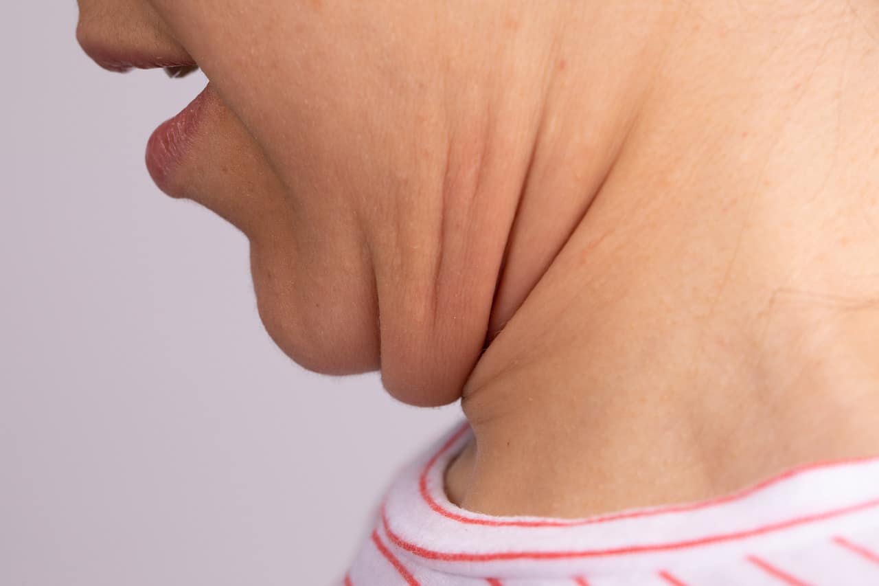 Causes, Implications And Corrective Suggestions: HealthifyMe