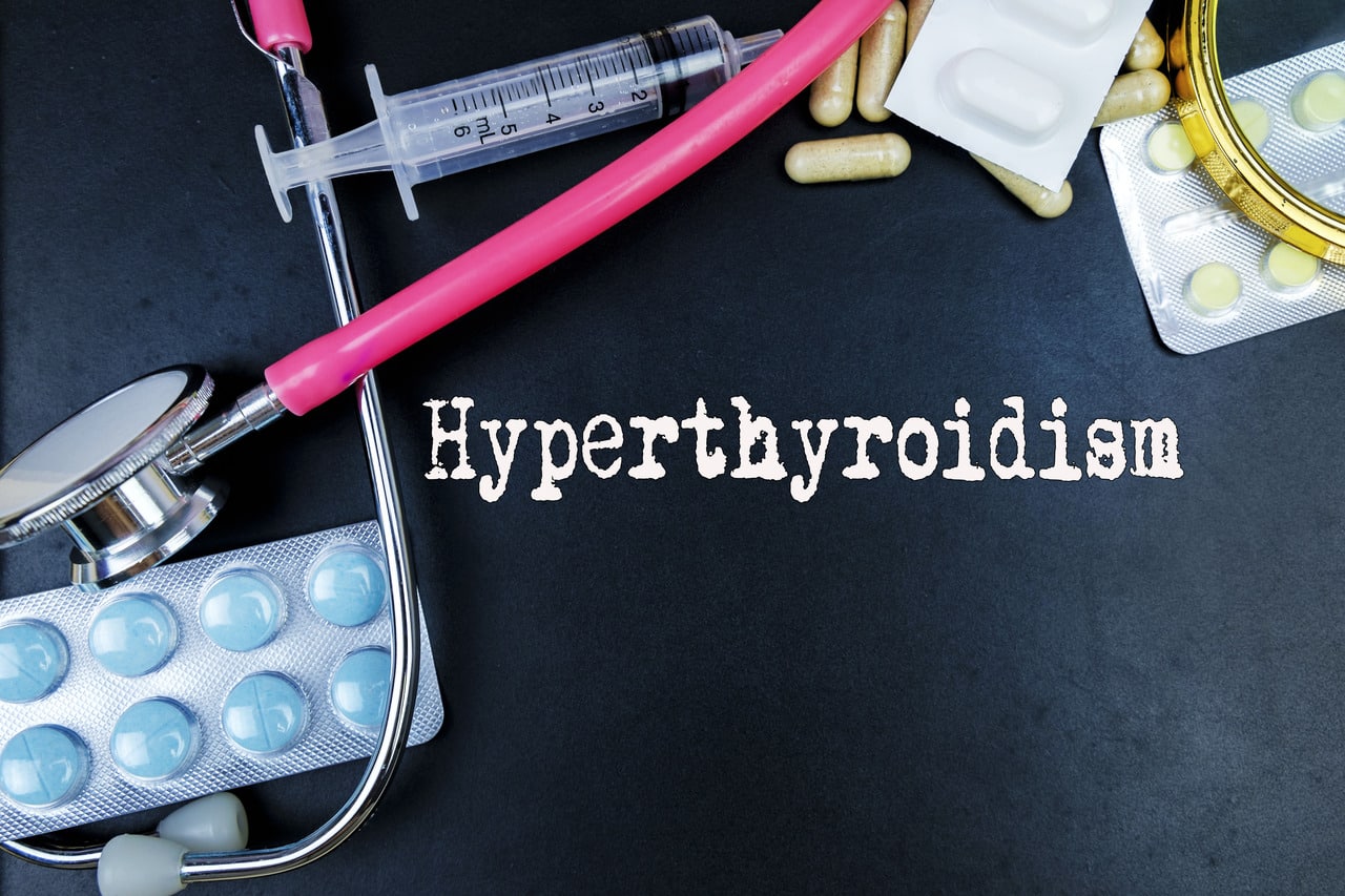 Hyperthyroidism: Triggers, Signs, Therapies, and Weight Control